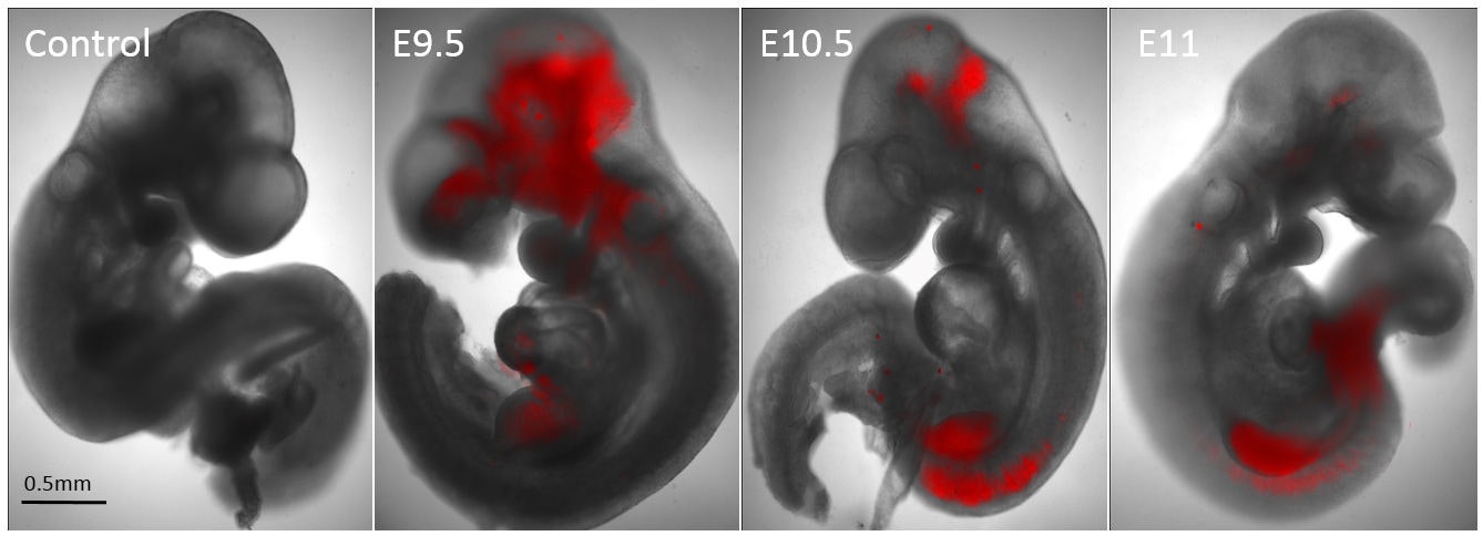 Mouse chimera-embryos with RFP-human colorectal cancer cell