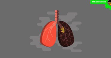Lung Cancer