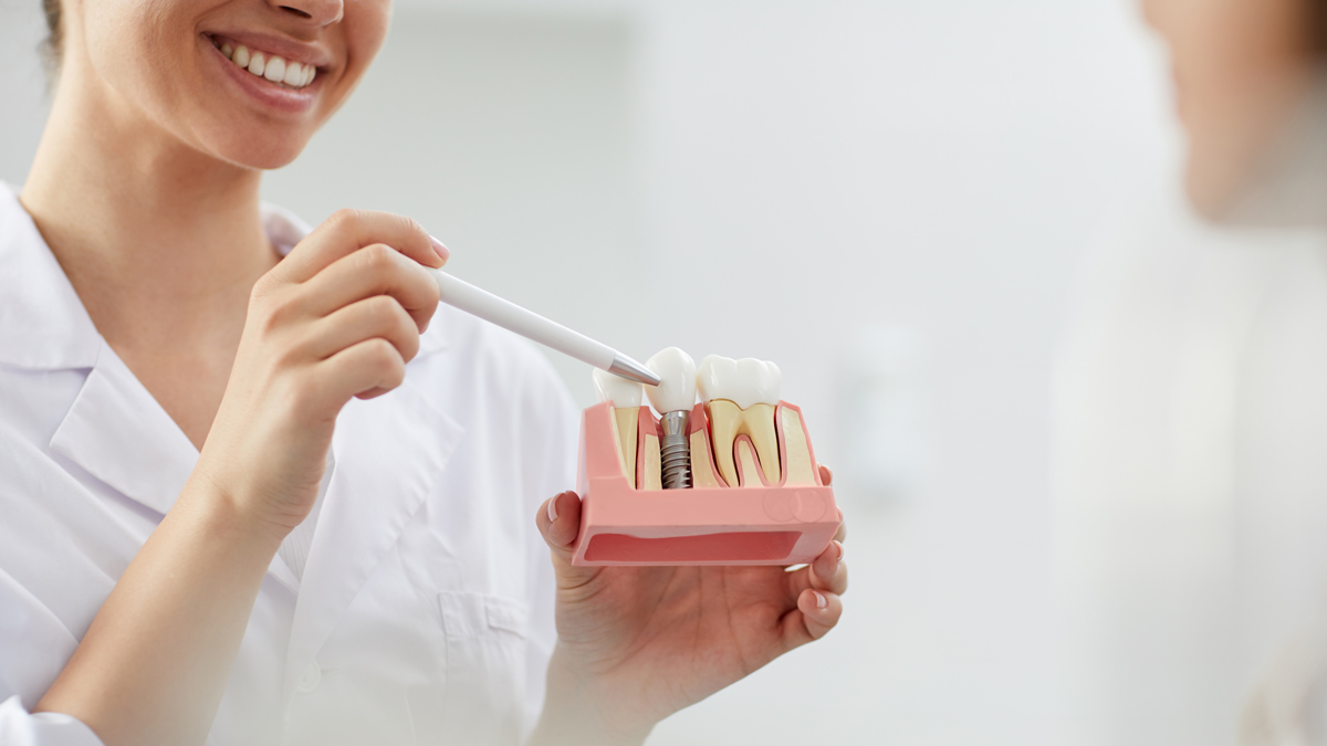 Dental Implants