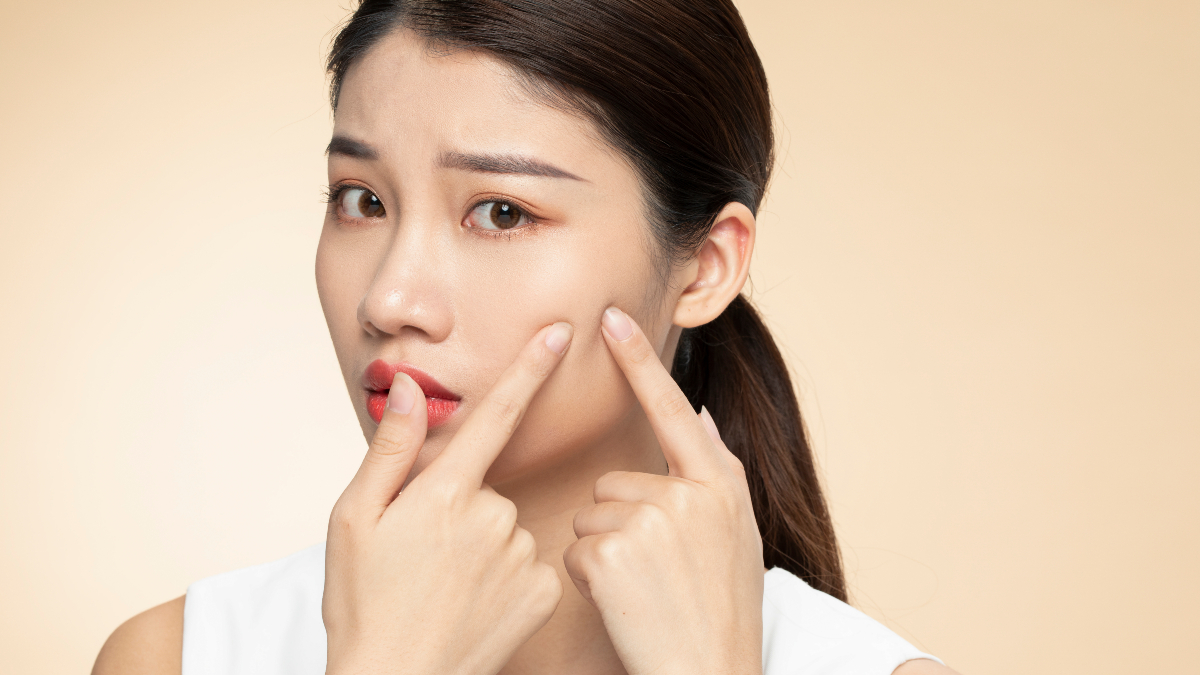 Oily Skin, Go Away: Beat the Blues With the Best Tips!