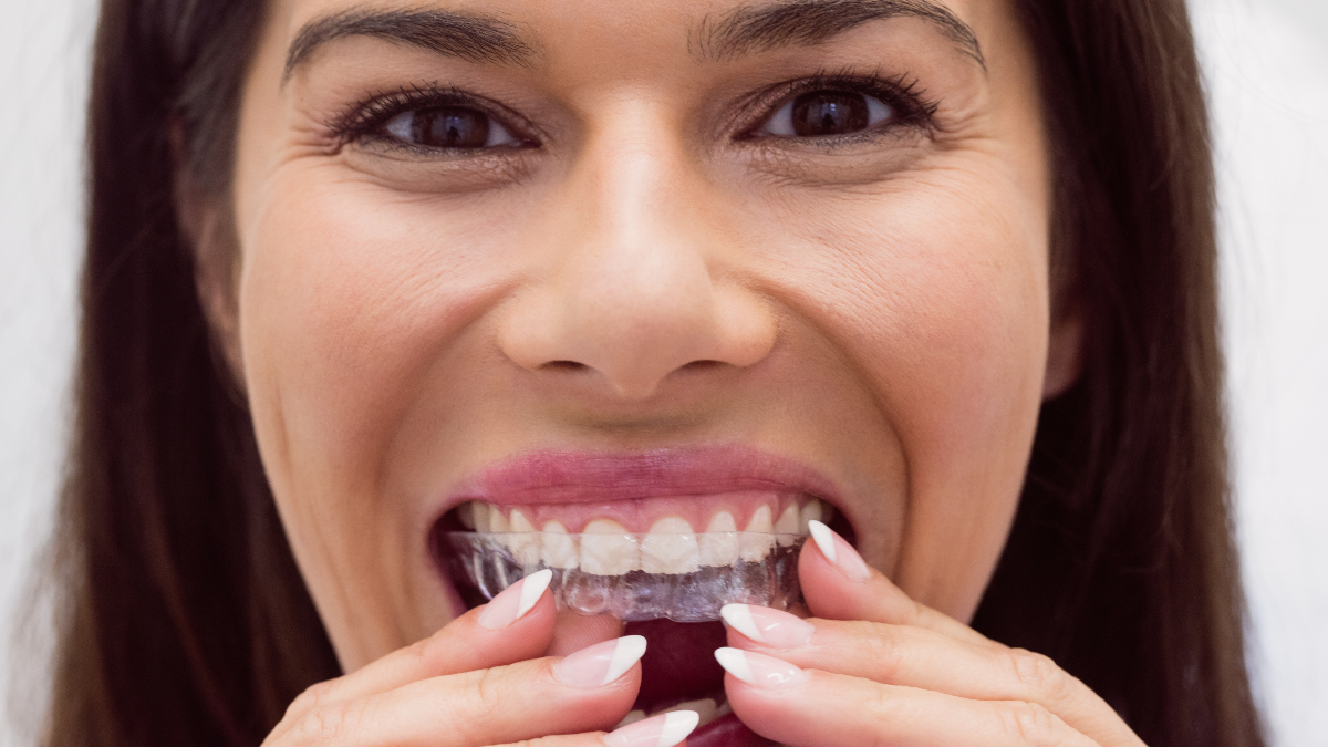 How to Take Care of Your Invisalign Aligners